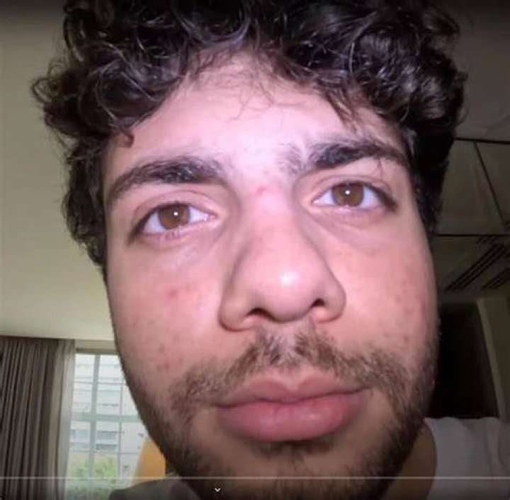 Spoonkid Face Reveal